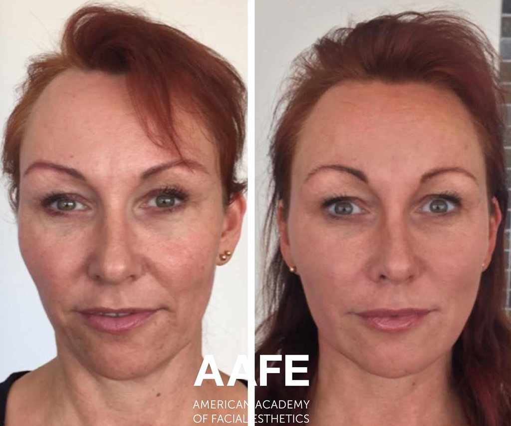 Before-&-After5-compressed